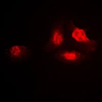 SAE2 / UBA2 Antibody (C-Terminus)