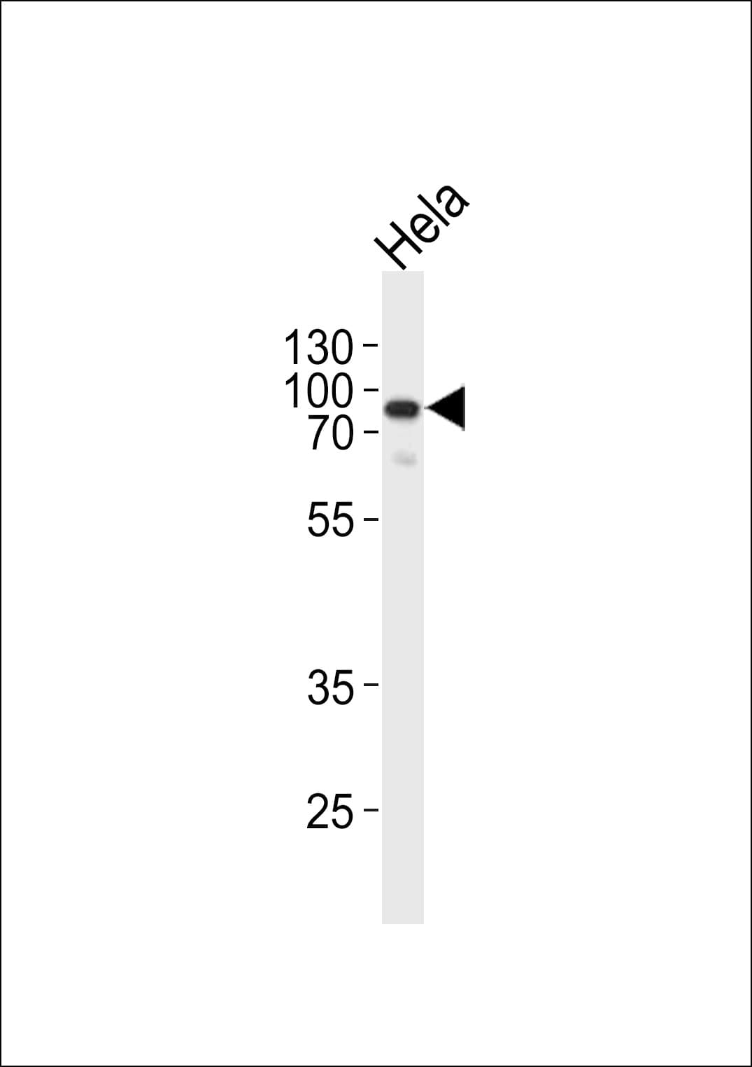 EWSR1 / EWS Antibody (aa623-652)