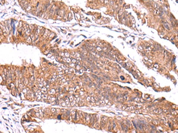 Polyclonal Rabbit anti-Human GATM / AGAT Antibody (IHC)