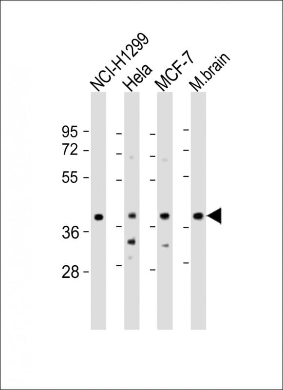TWF1 / PTK9 Antibody (aa201-235)