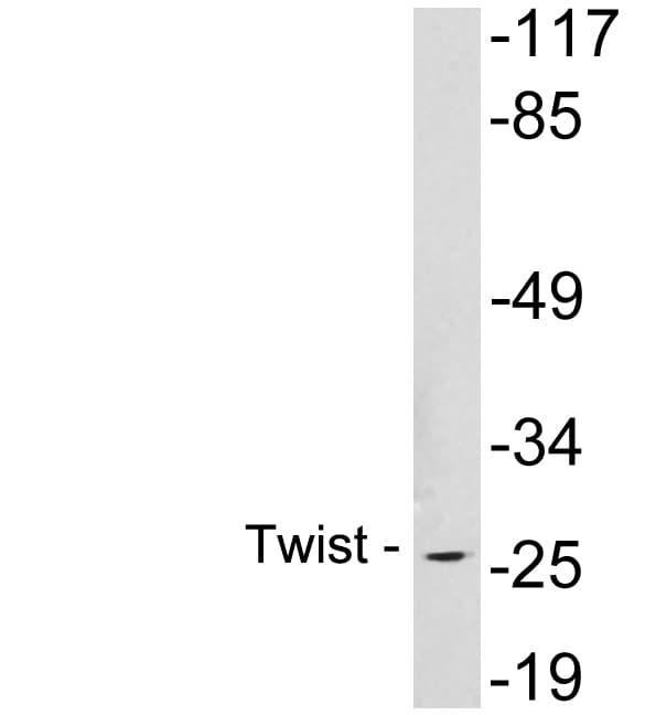 TWIST1 / TWIST Antibody (aa22-71)