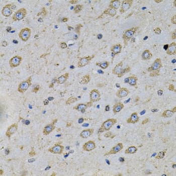 ATP2A2 / SERCA2 Antibody