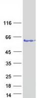 Human VPS72 Protein (Recombinant Myc-DDK (Flag))