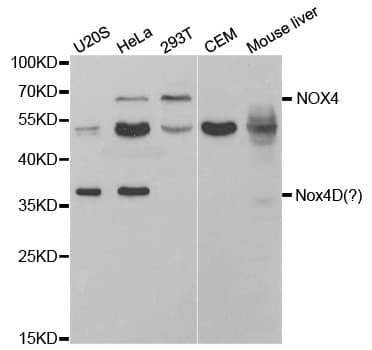 Polyclonal Rabbit anti-Human NOX4 Antibody (IHC, IF, WB)