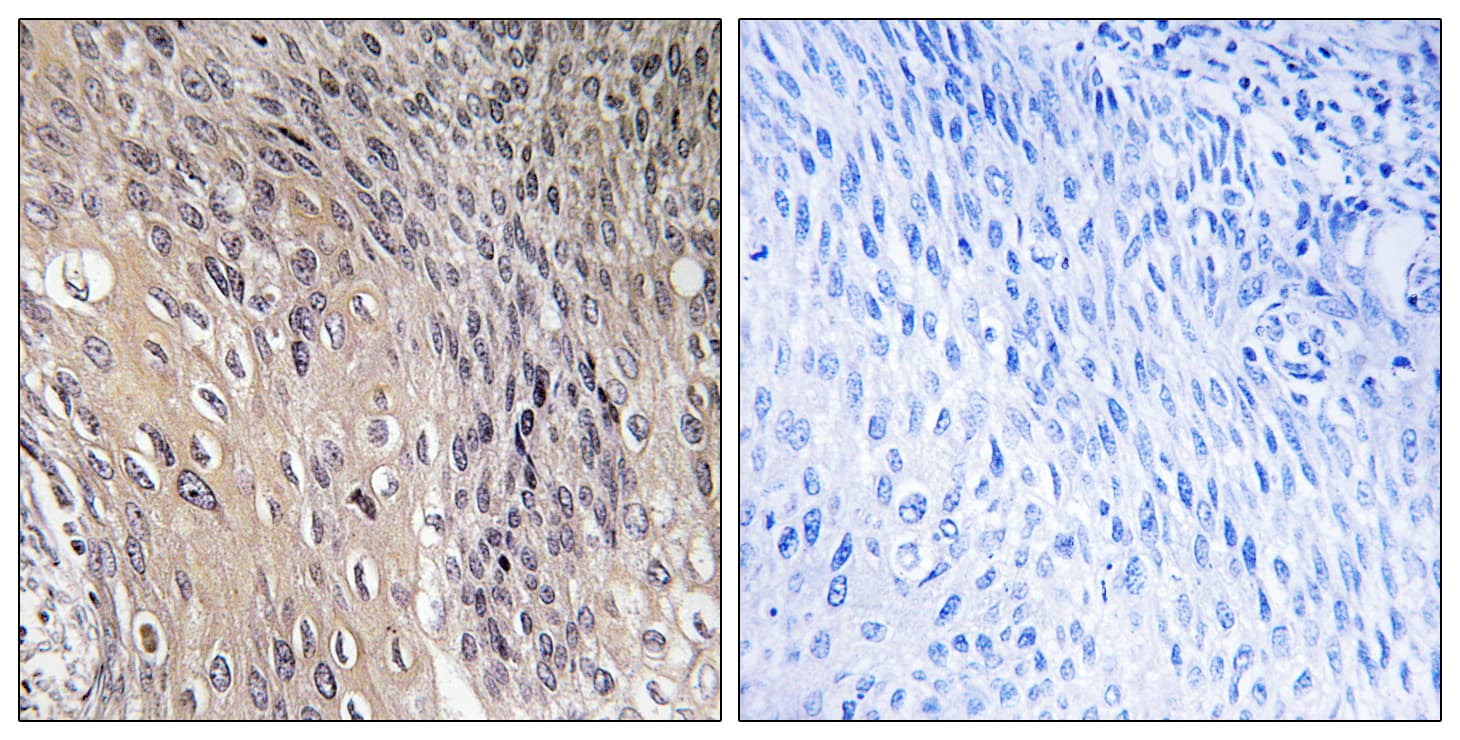 ARHGDIA / RHOGDI Antibody (phospho-Ser174)