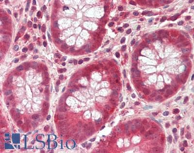 Polyclonal Rabbit anti-Human ACSS2 / ACAS2 Antibody (aa31-60, IHC, WB)