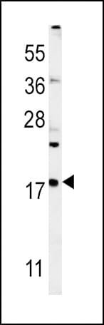 Polyclonal Rabbit anti-Human VAMP4 / VAMP-4 Antibody (aa16-45, IHC, WB)
