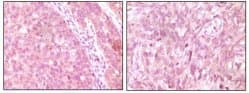 TIMP3 Antibody