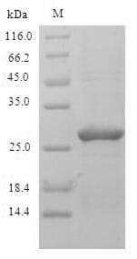Phleum pratense Pollen allergen Phl p 2 Protein (Recombinant 6His-SUMO, N-terminus)