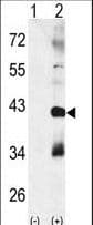 MAPK11 / SAPK2 / p38 Beta Antibody (aa133-161)