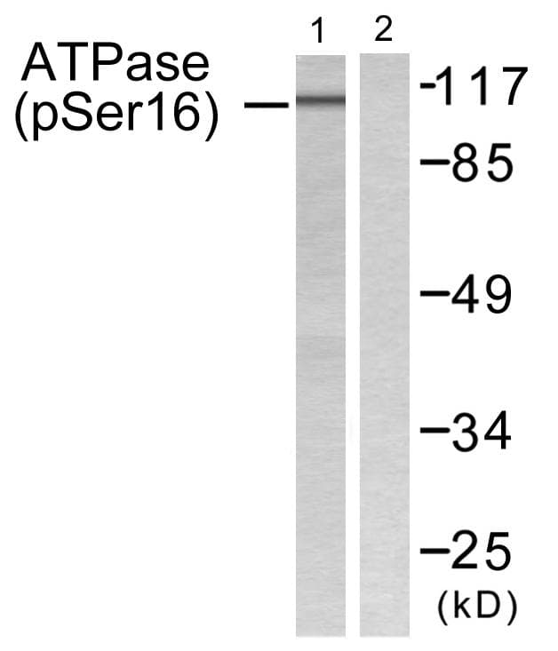 Polyclonal Rabbit anti-Human ATP1A1 Antibody (phospho-Ser16, IHC, WB)