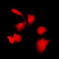 PRKACA + PRKACB Antibody (N-Terminus)
