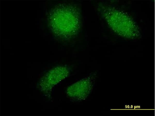 TTN / Titin Antibody (clone 2B3)