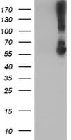 KCNJ3 / GIRK1 Antibody (clone OTI1G3)