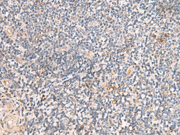 Polyclonal Rabbit anti-Human PEG1 / MEST Antibody (IHC, WB)
