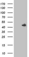 SEC14L2 Antibody (clone OTI1H3)