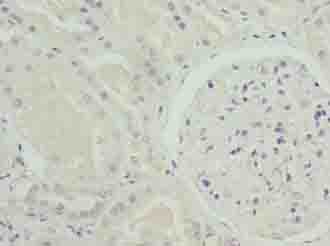 NOX4 Antibody