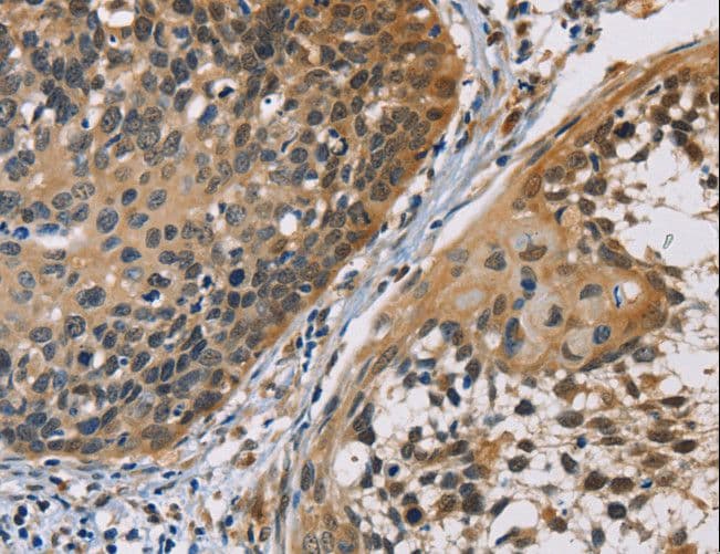 Polyclonal Rabbit anti-Human CBR / CBR1 Antibody (IHC, WB)