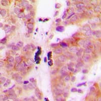 KLHL29 Antibody (Internal)