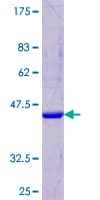 Human CST5 Protein (Recombinant GST)