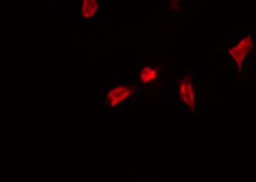 YAP / YAP1 Antibody (phospho-Ser127)