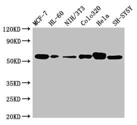 CALR / Calreticulin Antibody
