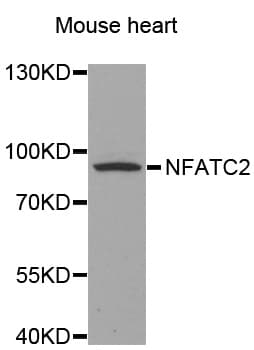 NFAT1 / NFATC2 Antibody (aa729-742)