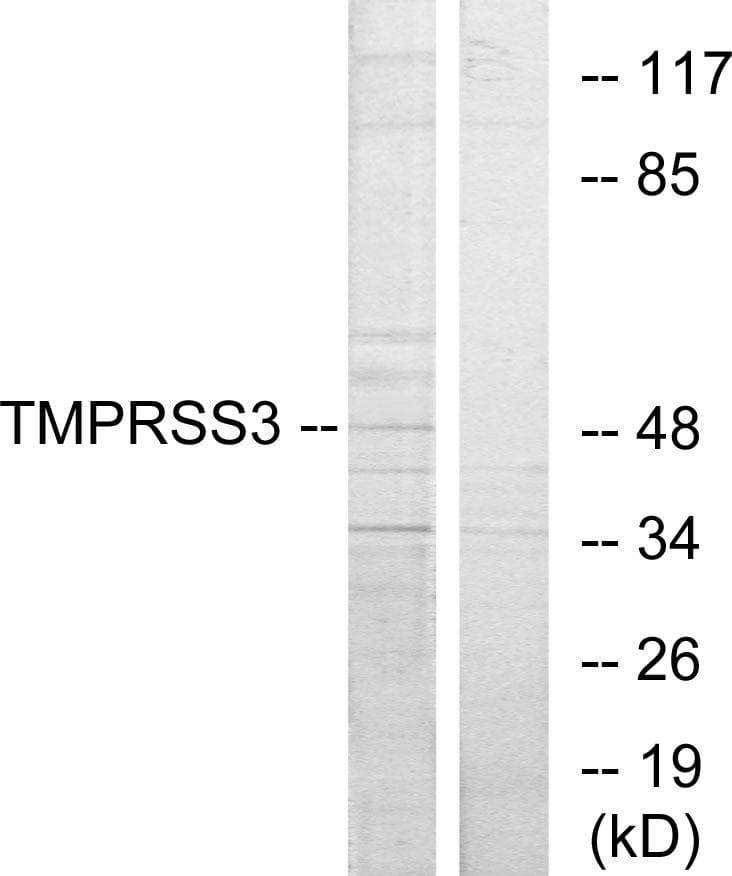 Polyclonal Rabbit anti-Human TMPRSS3 Antibody (IF, WB)
