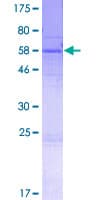 Human SPDYC Protein (Recombinant GST)