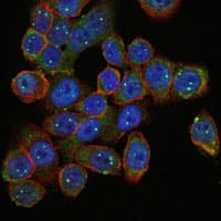 SMN1 Antibody (clone 5H1)