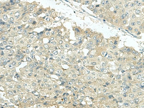 Polyclonal Rabbit anti-Human KIR2DL5A / KIR2DL5 Antibody (IHC, WB)