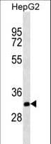 CTG-B45d / THAP11 Antibody (aa165-193)