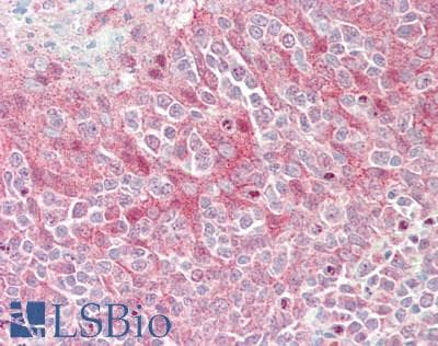 IHC-plus™ GP78 / AMFR Antibody (aa500-550)