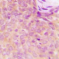 Polyclonal Rabbit anti-Human UBE1DC1 / UBA5 Antibody (C-Terminus, IHC, WB)