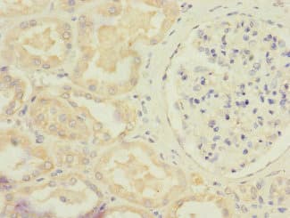 Polyclonal Rabbit anti-Human STRADA / LYK5 Antibody (IHC)