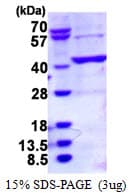Human BCAT2 Protein (Recombinant His)