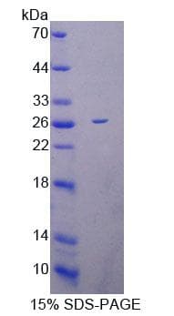 Mouse BM022 / MRPL1 Protein (Recombinant His-T7)