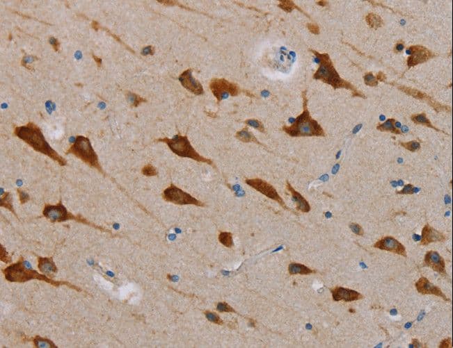 Polyclonal Rabbit anti-Human NAP1 / TAB3 Antibody (IHC, WB)