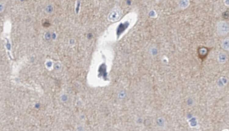 GUCY1A1 / GUCY1A3 Antibody