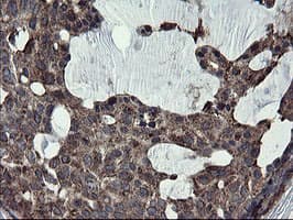 SKIL / SNO / SnoN Antibody (clone OTI3E9)