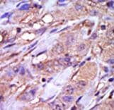 Polyclonal Rabbit anti-Human CSNK1E / CK1 Epsilon Antibody (aa331-360, IHC, WB)