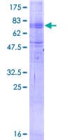 Human MFSD2A Protein (Recombinant GST)