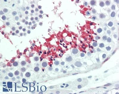 IHC-plus™ LIPE / HSL Antibody