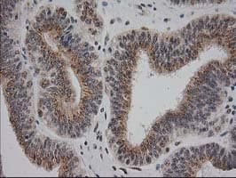 Monoclonal Mouse anti-Human MGLL / Monoacylglycerol Lipase Antibody (clone OTI1H1, IHC, IF, WB)