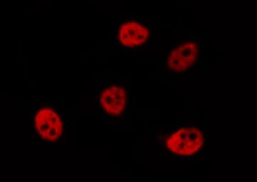 PSMC3 Antibody