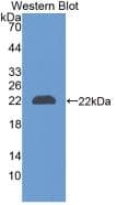 LCN2 / Lipocalin 2 / NGAL Antibody (PE)