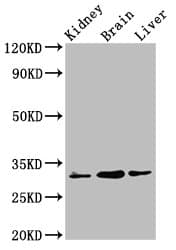 Polyclonal Rabbit anti-Human C6orf134 / ATAT1 Antibody (IHC, WB)