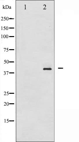 HDAC8 Antibody (phospho-Ser39)