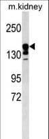 SUR2 / ABCC9 Antibody (aa640-669)