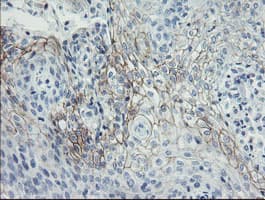 Monoclonal Mouse anti-Human SPINT1 / HAI-1 Antibody (clone OTI4E1, IHC, IF, WB)